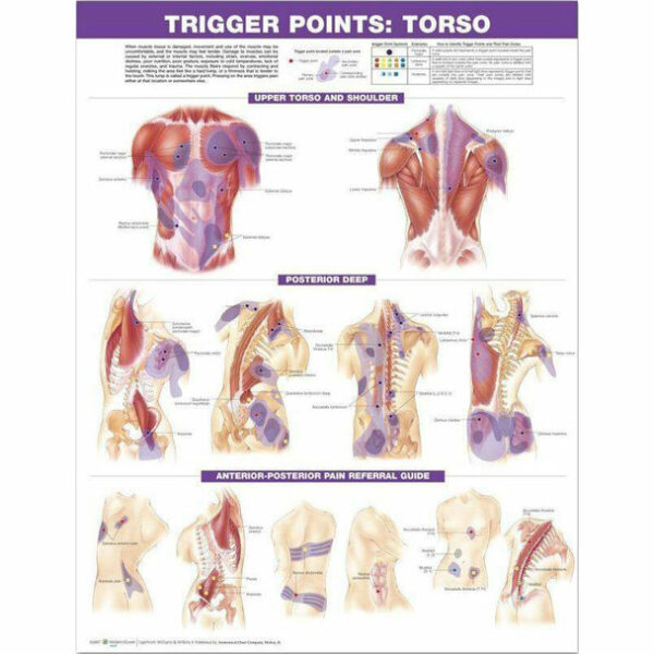 Trigger Points Chart Set: Torso and Extremities